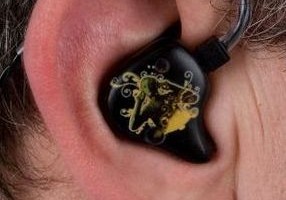 Egyénre készített fülhallgatók