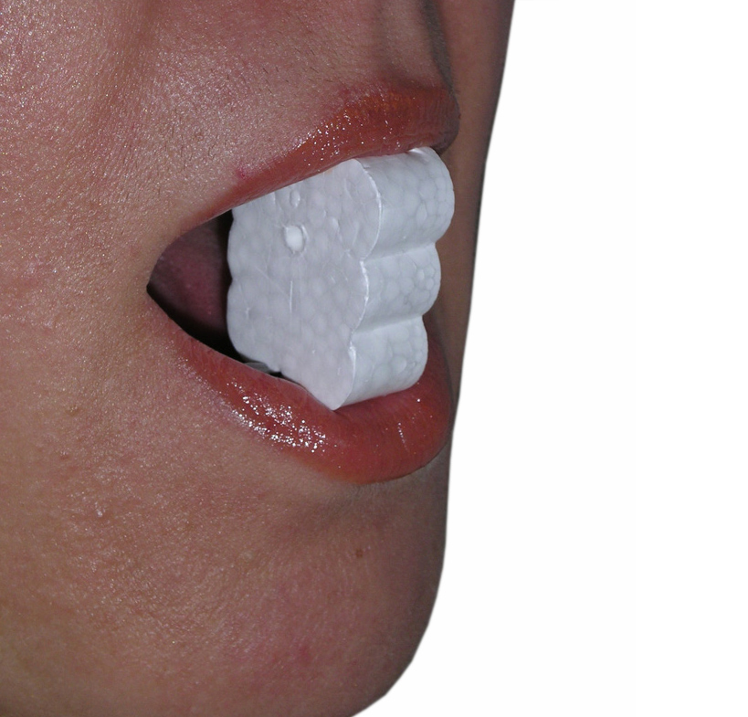 Harap&aacute;s g&aacute;tl&oacute;